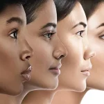 عمل بینی گوشتی سخت تر است یا استخوانی؟