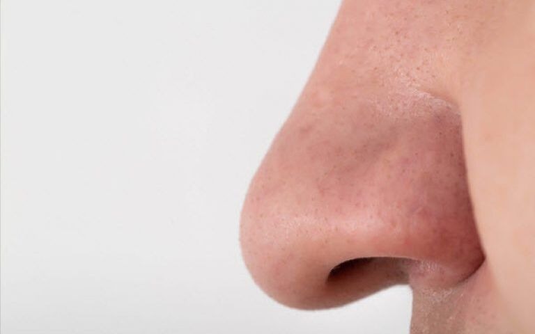  میزان سختی عمل بینی گوشتی یا استخوانی