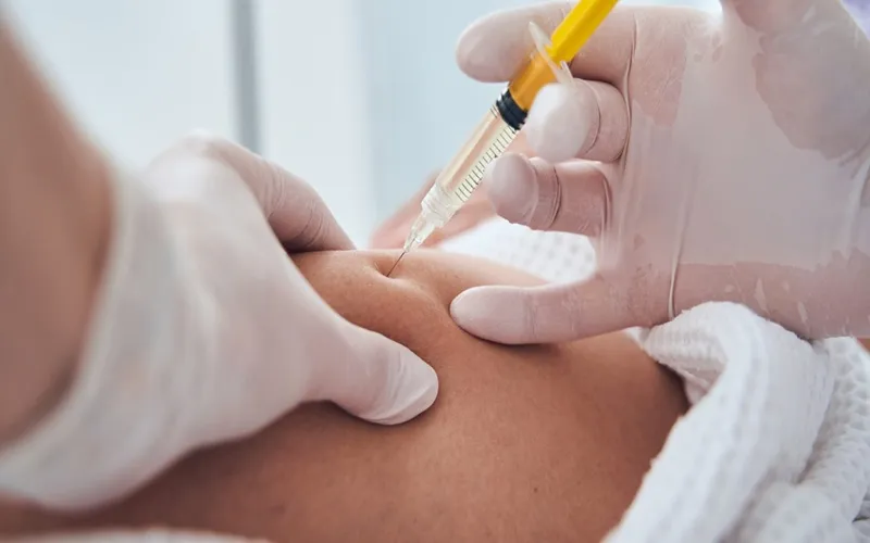 سفت شدن چربی تزریق‌ شده