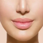 در جراحی لب، برش‌ها کجا زده می‌شوند و چرا محل برش‌ها مهم است؟