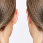 فرم‌دهی غضروف چگونه بدون شکستگی انجام می‌شود؟