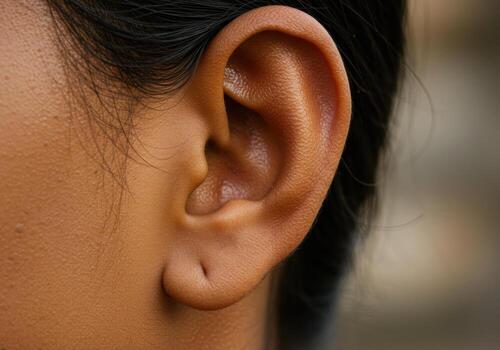 فرمدهی غضروف گوش بدون شکستگی