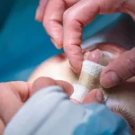 تنگی نفس بعد از جراحی بینی؛ تورم بینی از چیست؟