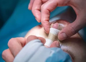 تنگی نفس بعد از جراحی بینی؛ تورم بینی از چیست؟