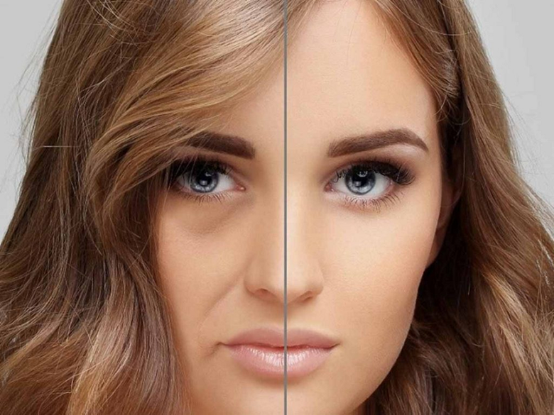 ماندگاری تزریق چربی