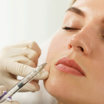 ماندگاری تزریق چربی به چه عواملی وابسته است؟