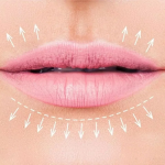 کاربردی ترین روش کم کردن فاصله لب و بینی بدون جراحی