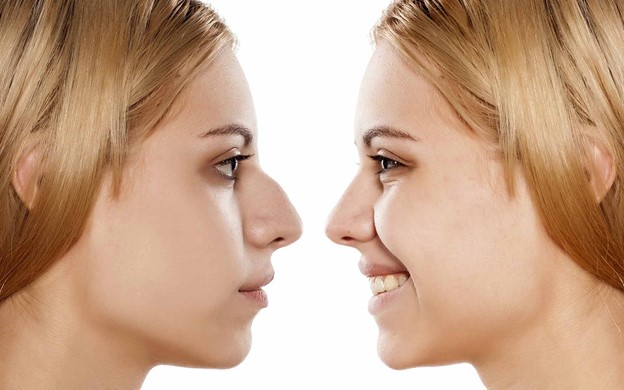 تشخیص بینی گوشتی یا استخوانی