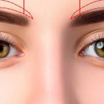 لیفت ابرو در اتاق عمل؛ ابروها بر چه اساسی در موقعیت جدید ثابت می‌شوند؟