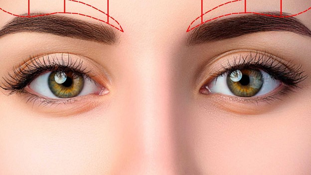 لیفت ابرو در اتاق عمل؛ ابروها بر چه اساسی در موقعیت جدید ثابت می‌شوند؟