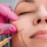 قبل از تزریق چربی، از کدام نواحی بدن چربی با کیفیت‌تری برداشت می‌شود؟