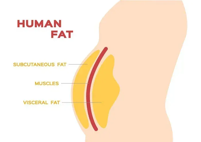 میزان چربی قابل برداشت از شکم و پهلو در یک جلسه لیپوماتیک چقدر است؟