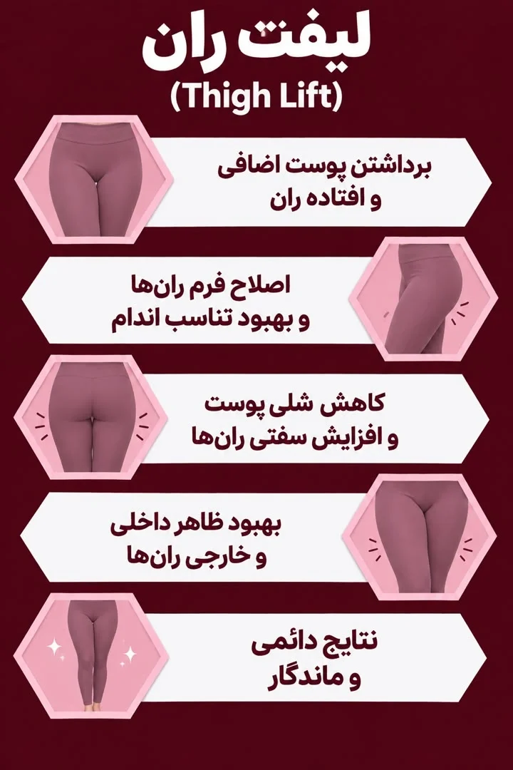 http://لیفت%20ران