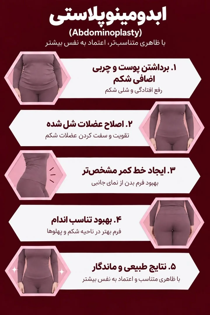 http://ابدومینوپلاستی