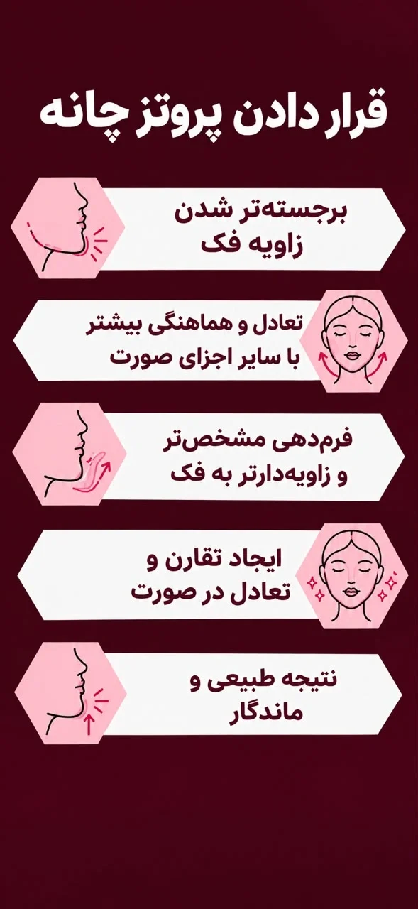 http://قراردادن%20پروتز%20چانه