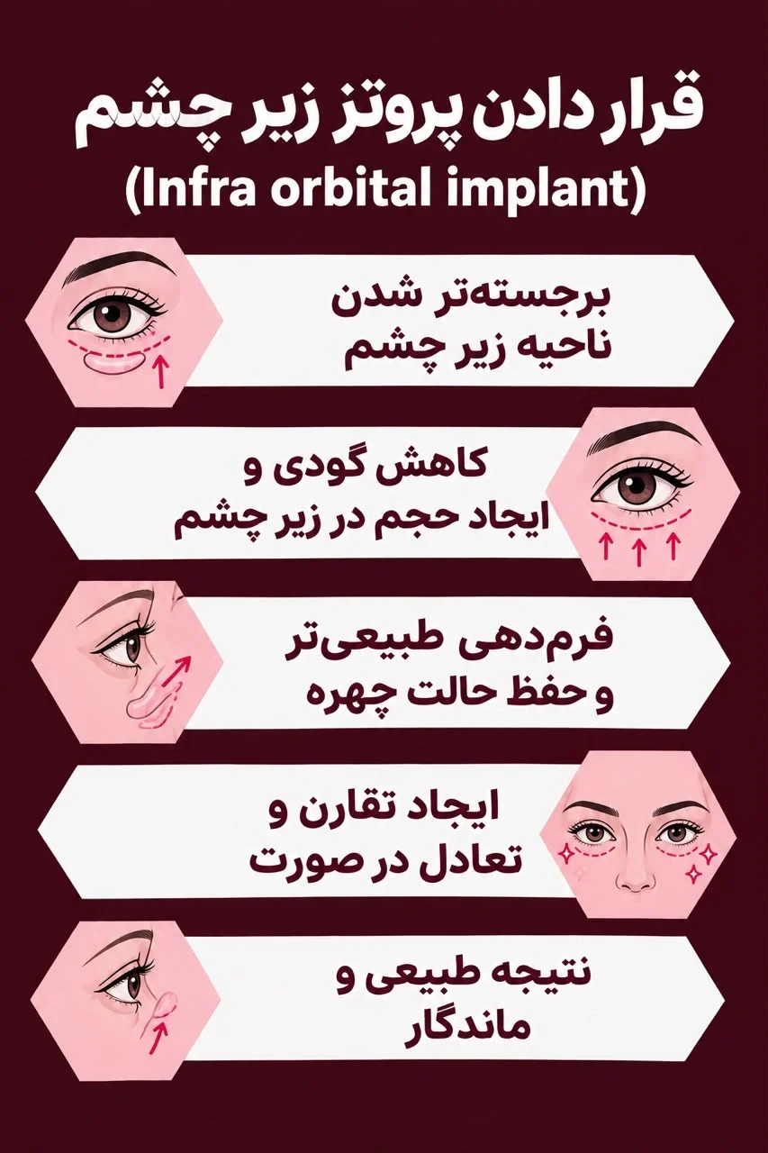 http://پروتز%20زیر%20چشم