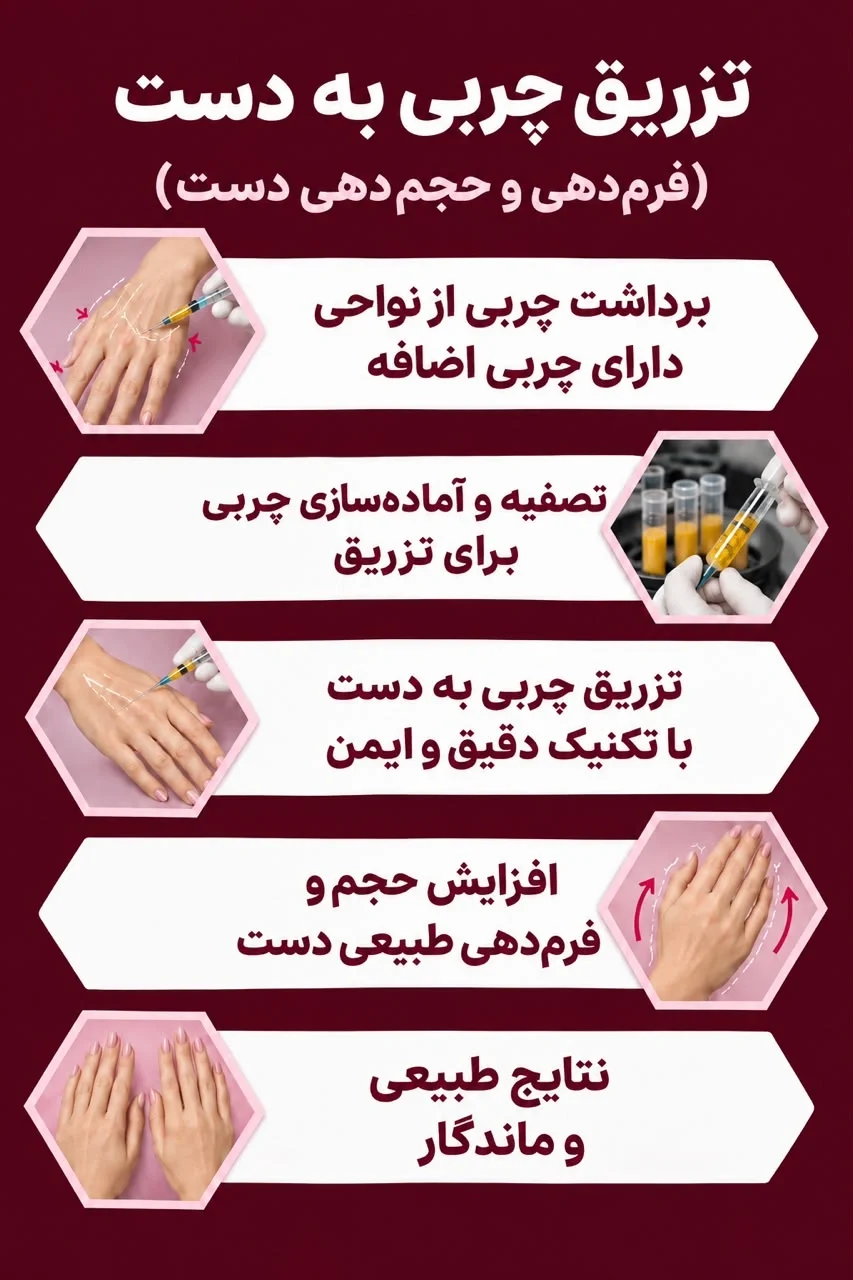 http://تزریق%20چربی%20به%20دست