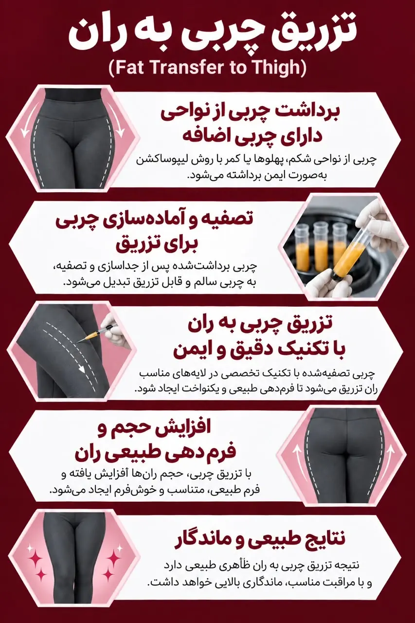 http://تزریق%20چربی%20به%20ران