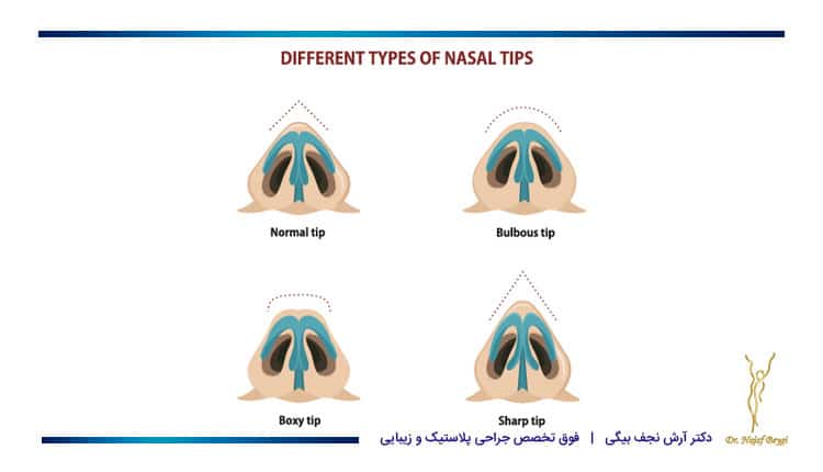 انواع نوک بینی