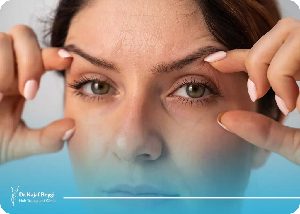 علت افتادگی پلک بعد از بوتاکس + درمان آن