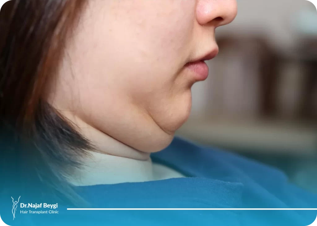 روش های از بین بردن غبغب