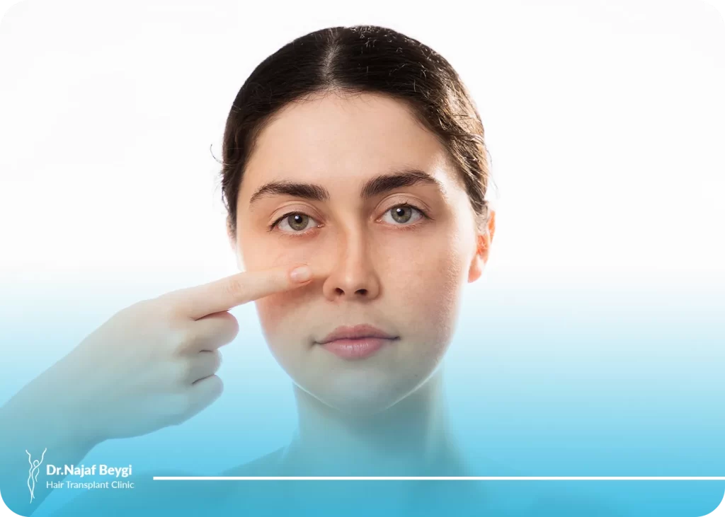 علت کج شدن بینی بعد از عمل