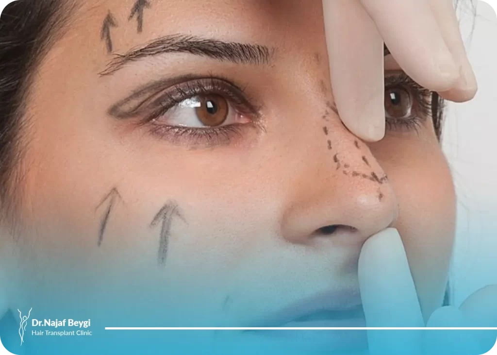 علت افتادگی نوک بینی بعد از عمل و عوامل موثر بر آن