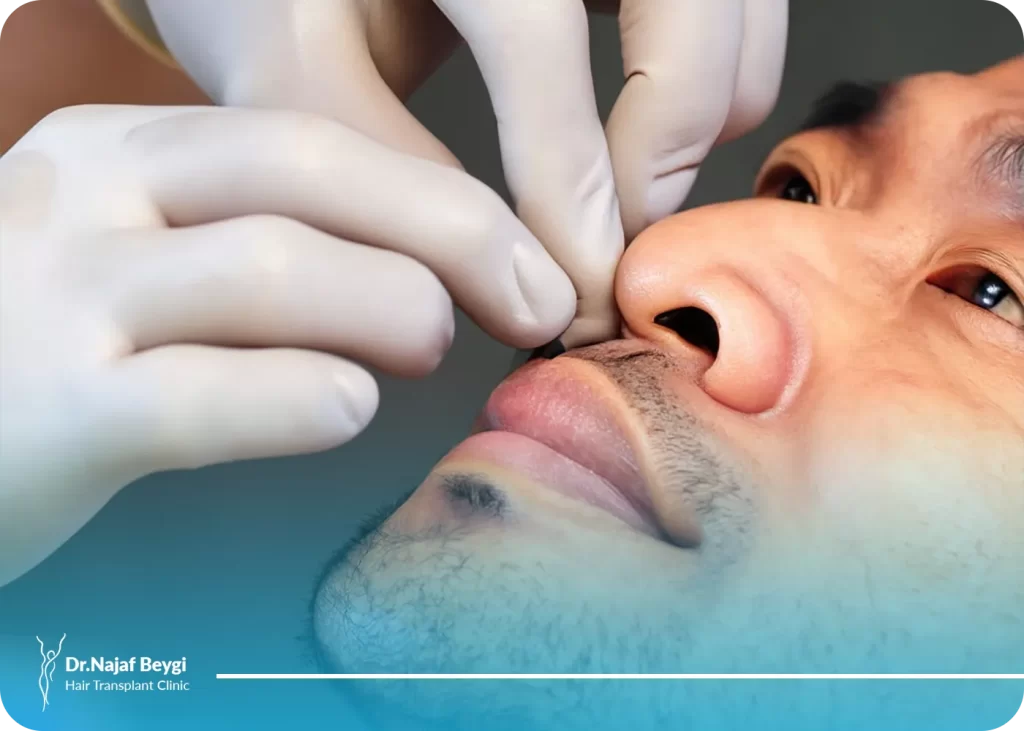 آلار پلاستی (عمل کوچک کردن پره های بینی) چیست و کاربرد آن چیست؟