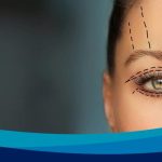 بهترین سن برای عمل بلفاروپلاستی